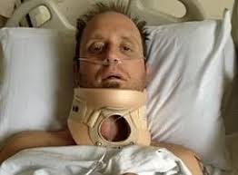 New York woman, 24, has scaling disorder that causes her skin to shed 10  times faster