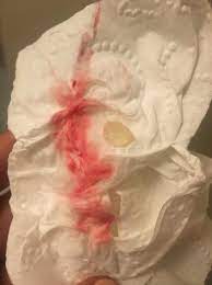 We did not find results for: Bleeding 6 Weeks Pregnant Babycenter