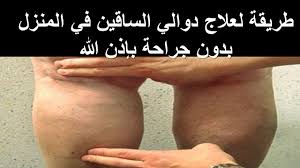 كنز جعله الله علاج دوالي الساقين ويشفي بسرعة، يقدم الدكتور مازن السقا طرق طبيعية لمحاربة الأوردة. Ø·Ø±ÙŠÙ‚Ø© Ø¹Ø§Ù„Ø¬Øª Ø£Ù…ÙŠ Ø¨Ù‡Ø§ Ù…Ù† Ø¨Ø±ÙˆØ² Ø§Ù„Ø¹Ø±ÙˆÙ‚ ÙˆØ¯ÙˆØ§Ù„ÙŠ Ø§Ù„Ø³Ø§Ù‚ÙŠÙ† Ø¨Ø¯ÙˆÙ† Ø¬Ø±Ø§Ø­Ø© Ø¨Ø£Ù‚Ù„ Ù…Ù† Ø£Ø³Ø¨ÙˆØ¹ Ø¨ÙØ¶Ù„ Ø§Ù„Ù„Ù‡ Youtube