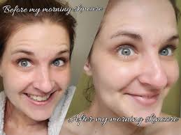 What I look like before my morning skin care routine and after 😂🥰 what's  your favorite morning routine self care item?