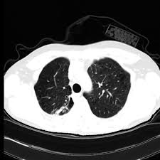 Rontgen Bilder Von Patienten Selbst Diagnose Stellen Wie Ein Arzt Der Spiegel