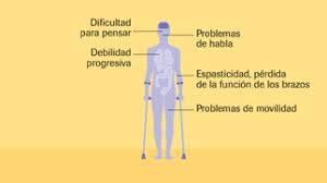 Esta recomendación es una adición a los criterios de 2010. Esclerosis Multiple Primaria Progresiva Diferencias Roche Pacientes