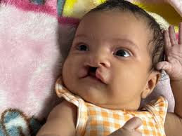 Fundraiser by Evan Hargis : Join Zora's Fight for a Brighter Smile