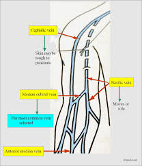 Image result for Venous Blood Sampling