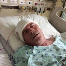 Prayer request for husband's recovery from brain bleed in Nassau