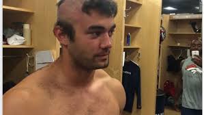 Broncos rookie Greg Latta has bad hair day
