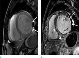 Kernspintomografie mrt) ist eine methodik, die in den letzten jahren eine rasante technische. Imri Investigative Magnetic Resonance Imaging