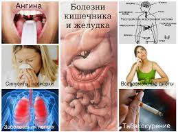 как избавиться от запаха изо рта во время поста Nepriyatnyj Zapah Izo Rta Kak Ot Nego Izbavitsya