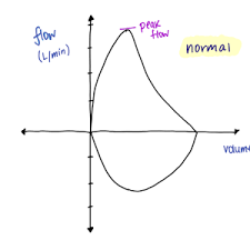 Image result for Pulmonary Function Test Lower Limit of Normal