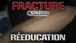 The head of the femur articulates with the acetabulum in the pelvic bone forming the hip joint. Fracture Du Femur Partie 5 La Reeducation Youtube