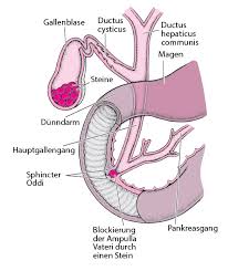 Ein gallenstein, auch cholelith (altgriechisch χολή. Gallensteine Leber Und Gallenstorungen Msd Manual Ausgabe Fur Patienten