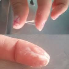 Menstruacao Atrasada A 5 Dias Corrimento Branco Elastico Me Ajudem Meninas Obrigada D Jovens Tentantes Babycenter
