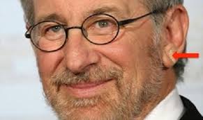 Frank Çizgisi ve Damar Hastalıkları İlişkisi Ozon Terapist