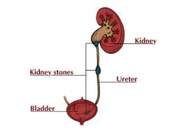 Pin On Kidney