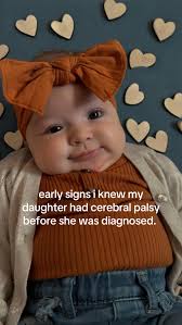 9 Month Old with Cerebral Palsy