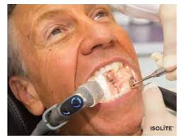 Zyris Isolite Pro (Formerly Isolite 3) Review