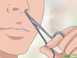 Ingrown hair is a common condition that results from hair removal. How To Treat Ingrown Nose Hairs 11 Steps With Pictures
