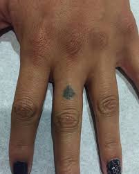 Our expert staff have performed over 100,000 laser treatments. Zap That Tatt Laser Tattoo Removal Home Facebook