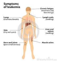 The signs and symptoms of blood cancer are not yet clear and often do not get detected in early stages. Symptoms Of Leukemia Blood Cancer