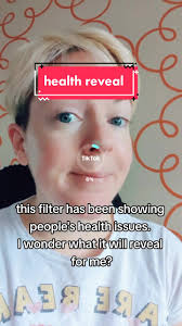 Ai Filter Tells You If You Are Sick