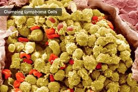 Some of these tissues include the lymphatic system according to blood cancer treatment experts, the exact reasons behind leukemia are not known but is thought to be a combination of genetic and. Blood Cancer Types Leukemia Lymphomas Myelomas And More