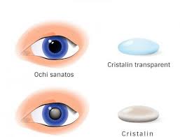 We did not find results for: Pregatirea Pentru OperaÈ›ia De CataractÄƒ Spectrum Clinique
