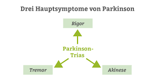 Seperti yang telah dikatakan sebelumnya, penyakit ini memburuk secara bertahap seiring berjalannya waktu, dan terbagi menjadi 5 tingkatan. Parkinson Syndrom Der Grosse Ratgeber Zur Morbus Parkinson Krankheit Pflege De