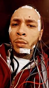 Defy What Normal, #sleepstudy #narcolepsy #cataplexy #inshallah🙏  #alhumdullilah #chosen #notnormal