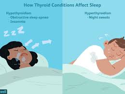 Fatigue, night sweats and weight loss (unintentional). How Can Thyroid Dysfunction Cause Sleep Problems