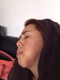 Yina calderón sigue generando no solo polémica sino preocupación entre sus seguidores por un video reciente en el que está cantando con la cara hinchada y vendada tras su cirugía. Fotos De Yina Calderon Antes Y Despues De Adelgazar Antes Y Despues Adelgazar Famosos Latinos