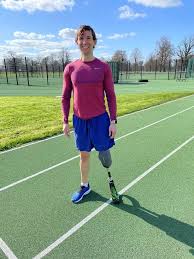 I chose to have a leg amputated to end crippling pain