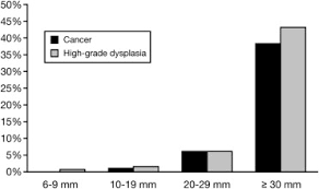 Does Polyp Size Matter Aga Journals Blog