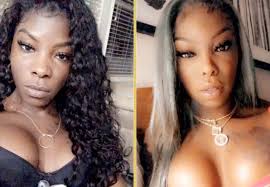 Facial Feminization Surgery (FFS) in Michigan