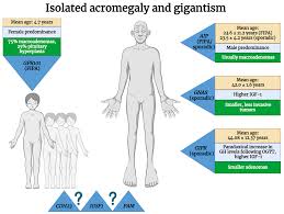 Image result for Acromegaly