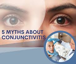 Image result for Conjunctivitis Resources