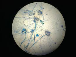 Image result for Botrytis cinerea