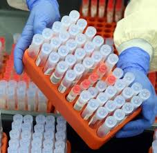 Bayerns ministerpräsident markus söder (csu) hat das geplante auslaufen der „epidemischen lage von nationaler tragweite. Corona Who Listet Neue Corona Mutation Aus Kolumbien Welt