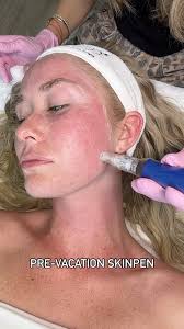 ✨ Ready for radiant skin? Our Glo2 Facials are designed to deeply cleanse,  hydrate, and rejuvenate your complexion. Experience the ultimate in luxury  skincare at Epitome by Shani. Book your appointment now