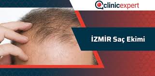 Izmir Sac Ekimi Clinicexpert Uluslararasi Saglik Hizmetleri