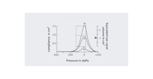 Image result for Tympanometry