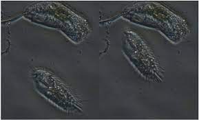 Maybe you would like to learn more about one of these? Amoeba Under Microscope Download Scientific Diagram
