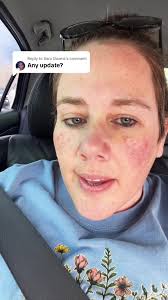 Fort Worth Update Lynn