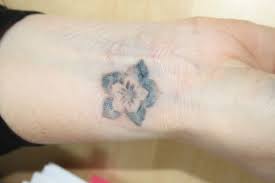 Will unbedingt ein tattoo stechen lassen, es soll nicht sehr groß sein (habe an einen notenschlüssel gedacht) und auf meinen rechten innen arm unterhalb vom handgelenk. Tattooentfernung Vorher Nachher Fotos