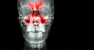 Paranasal Sinuses The Definitive Guide Biology Dictionary