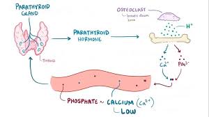 Image result for Hyperphosphatemia