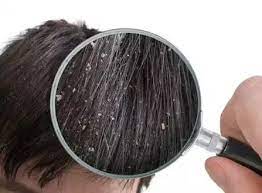 Does cutting hair promote hair growth? Does Hair Gel Cause Permanent Hair Loss Are Alcohol Free Hair Gels Better Quora