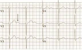 Image result for U Wave