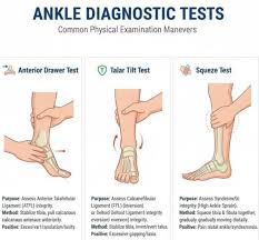 Image result for Ankle External Rotation Test