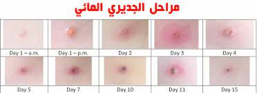 Aug 19, 2020 · 6. ØªÙ… Ø§Ù„Ø§Ù†ØªÙ‡Ø§Ø¡ Ù…Ù† Ù‡ÙŠØ¦Ø© Ø§Ù„Ù…Ø­Ù„ÙÙŠÙ† Ù…Ø³ÙƒÙ† Ø­Ø¨ÙˆØ¨ Ø§Ù„Ø¬Ø¯Ø±ÙŠ Uccrandolph Org