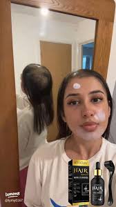 Minoxidil for Hair Growth: Effective Solutions and Tips